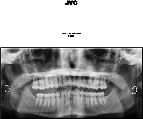 Jack Van Cleaf - Jvc 2LP (Explicit Lyrics, Bonus Tracks)