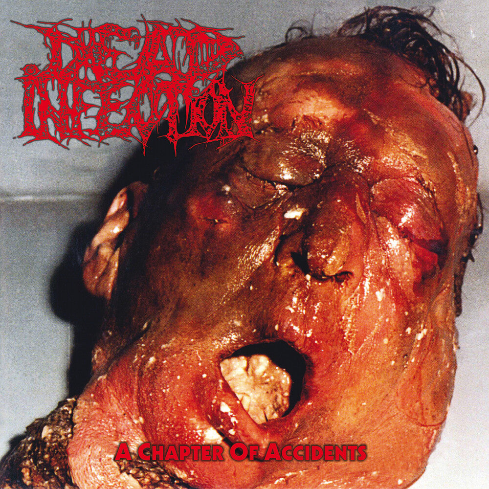 Dead Infection - Chapter of Accidents CD (Preorder: Ships July 10, 2026)